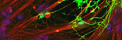Fibrous extensions of a nerve cell (red) and an oligodendrocyte (green) growing on top of the nerve cell
